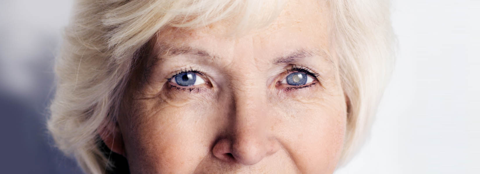 Cataract Surgery in New Holland