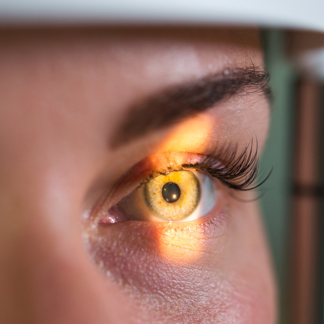 Vision Therapy in New Holland